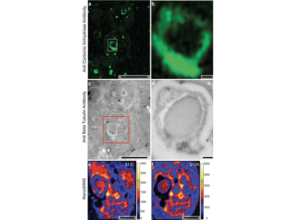 The correlative workflow combining immuno-fluorescence microscopy and immuno-electron microscopy with NanoSIMS imaging using Anti-Carbonic Anhydrase II Antibody